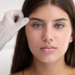 Brow Lift / Kaş Asma