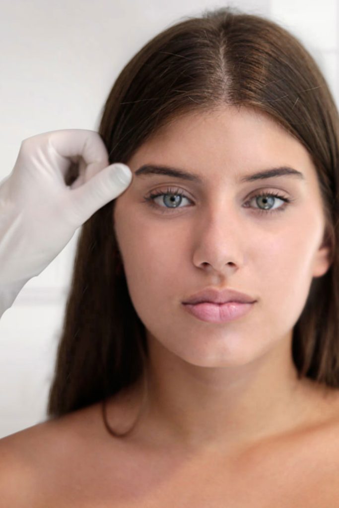 Brow Lift / Kaş Asma