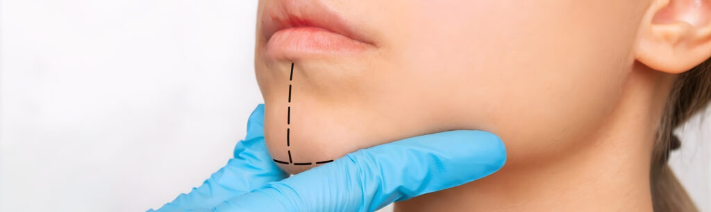 Dudak Dolgusu ve Lip Lift Rehberi